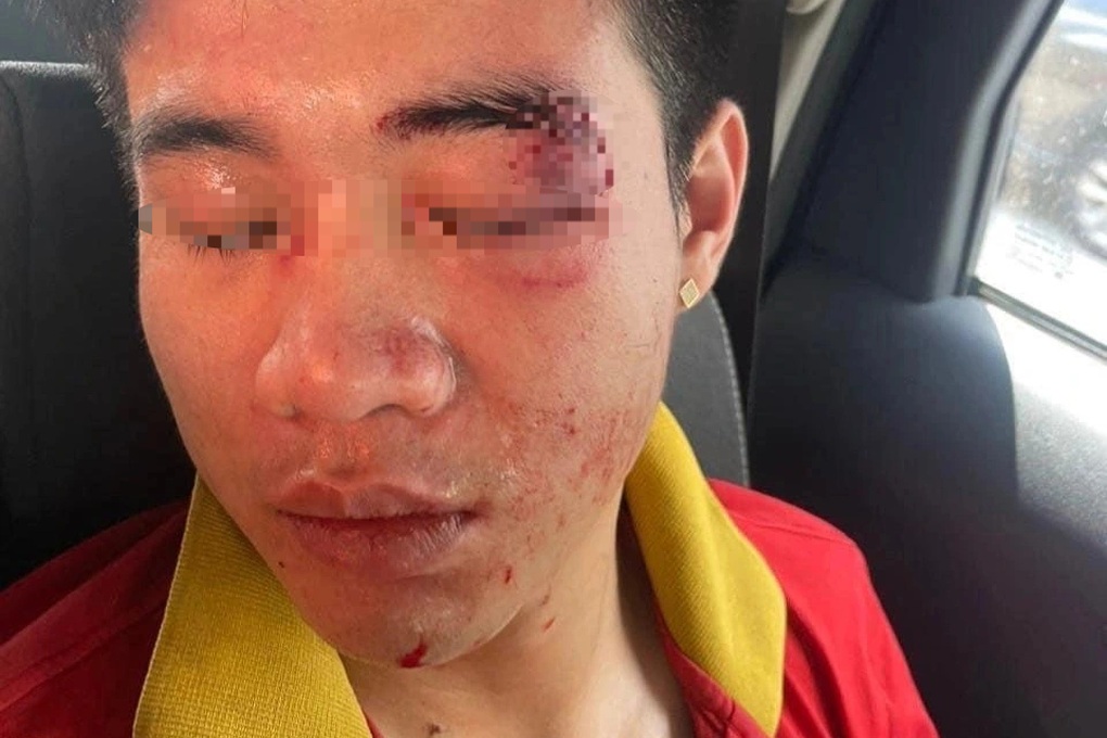 Một nam nhân viên nhà xe ở Hà Nội bị đánh hội đồng - 1 Một nam nhân viên nhà xe ở Hà Nội bị đánh hội đồng - 1