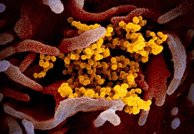 Hình ảnh thật sự của virus corona Covid-19 mới được trình diện - Ảnh 1. Hình ảnh thật sự của virus corona Covid-19 mới được trình diện - Ảnh 1.