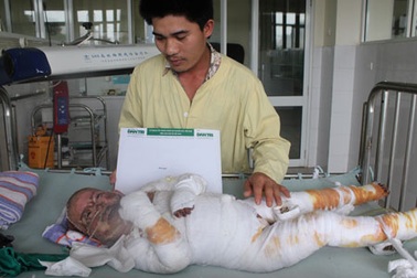 Hỗ trợ nóng 25 triệu đồng đến bé Thanh Thảo bị bỏng xăng