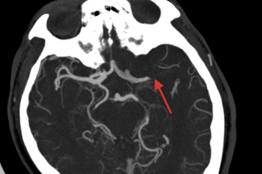 TPHCM: Nửa đêm, người chồng phát hiện vợ nguy kịch ngay trong khi ngủ