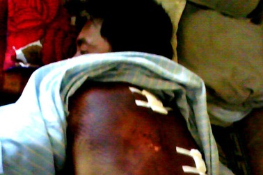 Sẽ làm nghiêm vụ một thanh niên bị “hành hình” dã man