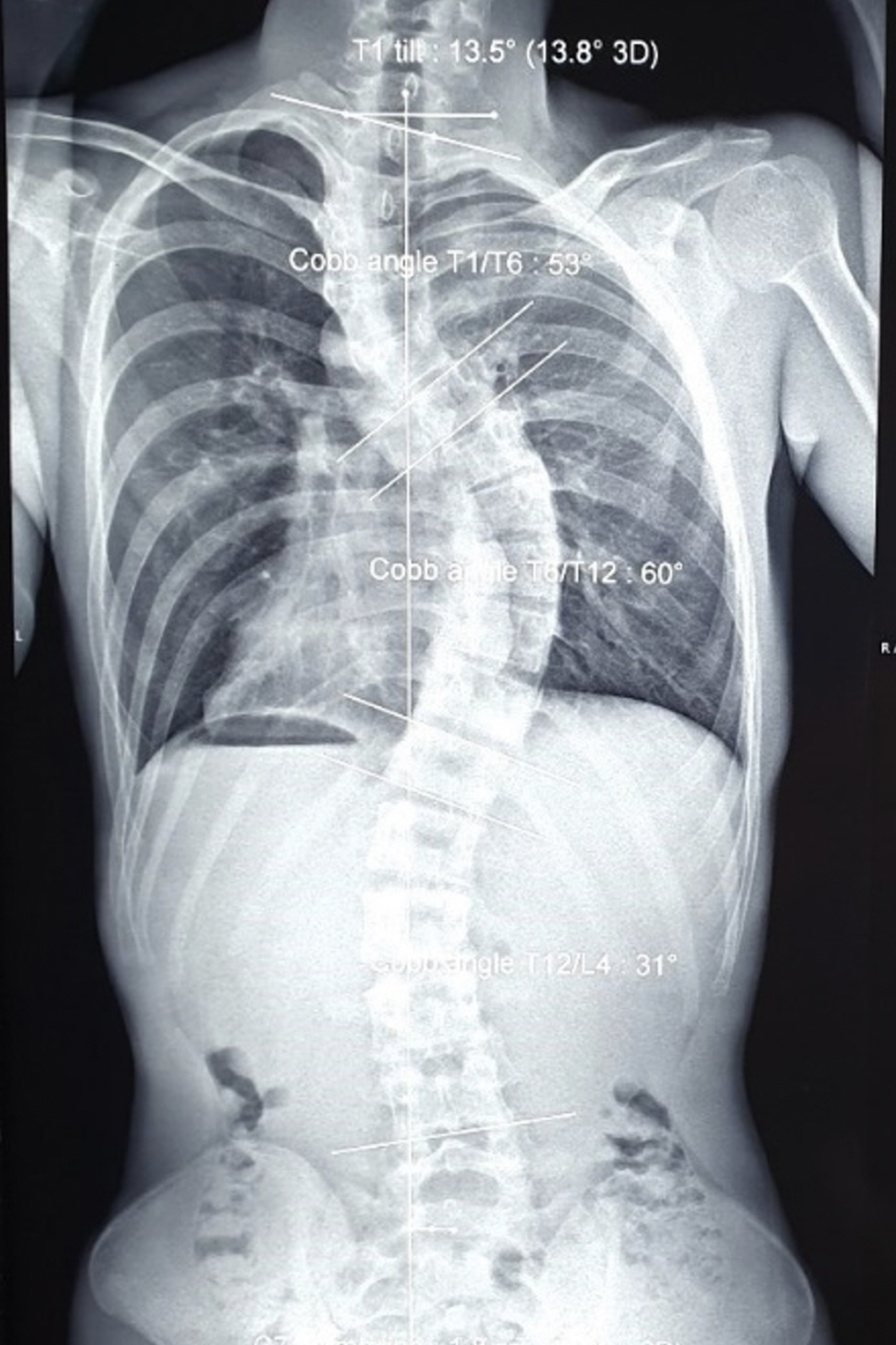 Căn bệnh hiểm khiến nam sinh càng học càng yếu khi sắp thi tốt nghiệp THPT - 3