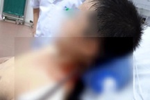 Cứu sống nam thanh niên bị thanh sắt đâm xuyên từ cổ qua não