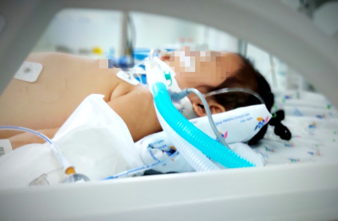 Ám ảnh lọn tóc khổng lồ quấn chặt dạ dày bé gái 4 tuổi vì hội chứng kỳ lạ - 2 Ám ảnh lọn tóc khổng lồ quấn chặt dạ dày bé gái 4 tuổi vì hội chứng kỳ lạ - 2