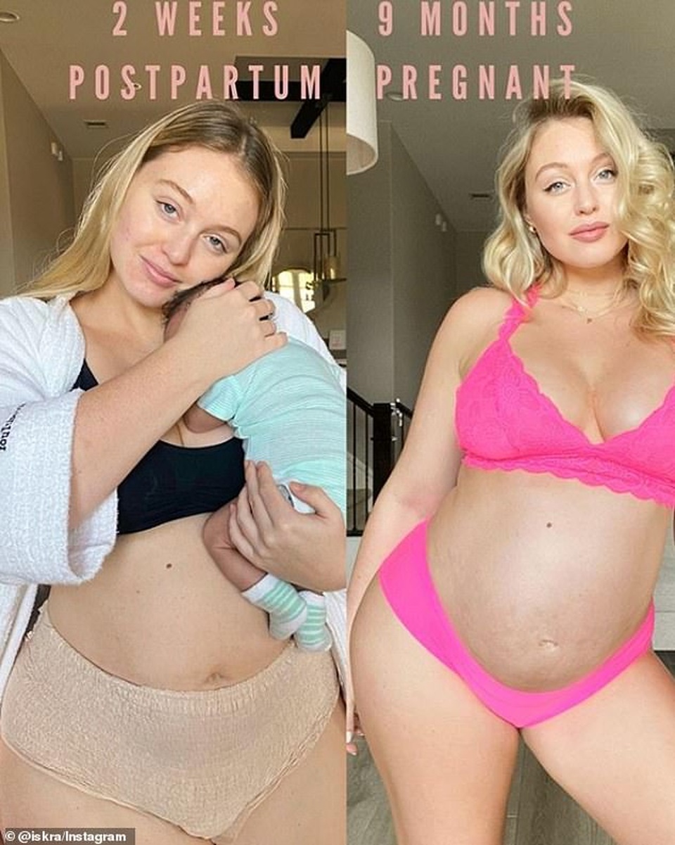Iskra Lawrence tự tin diện áo tắm sau khi sinh con - 6
