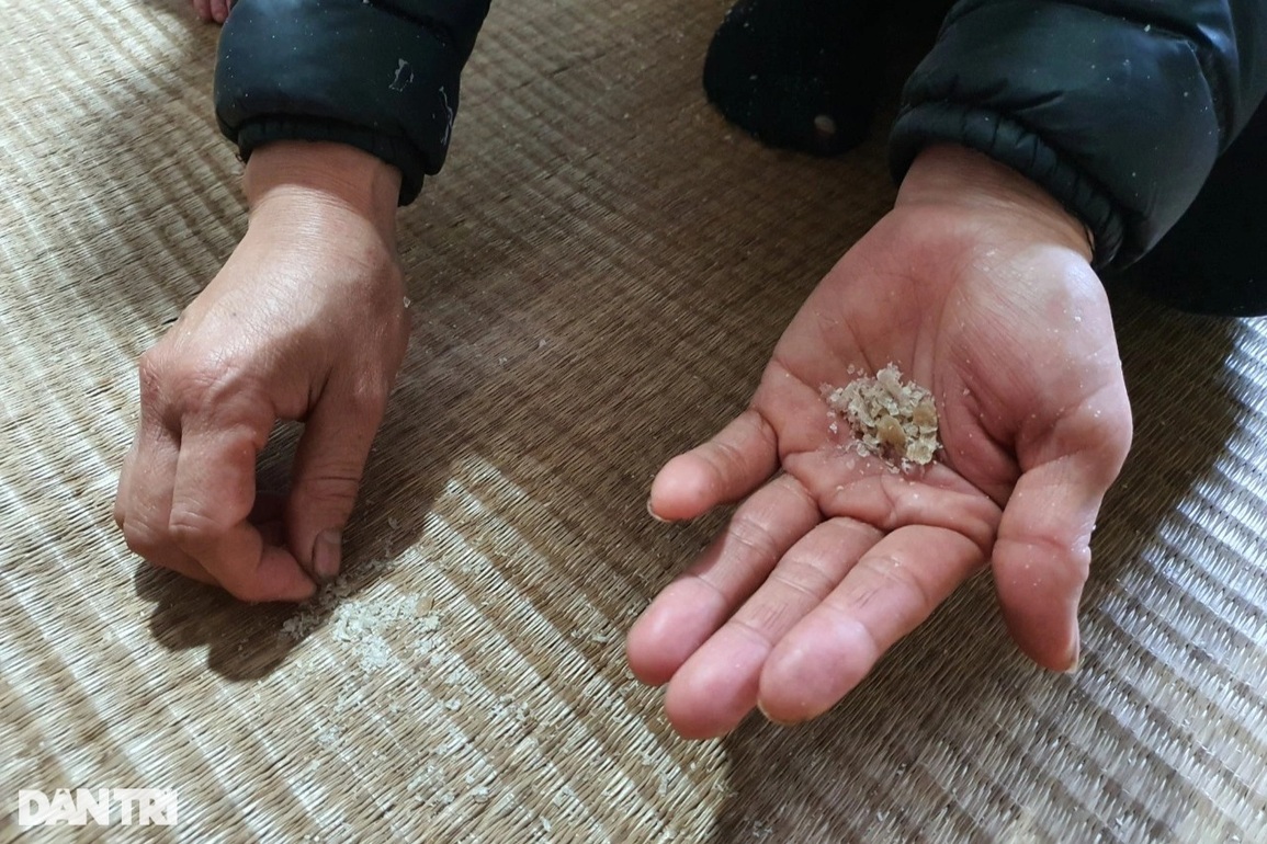 Thương bé trai 5 tuổi mắc căn bệnh kỳ lạ, đau đớn khóc thét mỗi lần mặc áo - 4 Thương bé trai 5 tuổi mắc căn bệnh kỳ lạ, đau đớn khóc thét mỗi lần mặc áo - 4