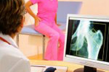 Loãng xương - Sát thủ giấu mặt