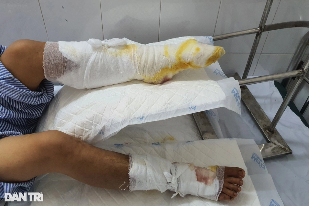 Bác sĩ quên Tết kêu gọi cứu giúp cô gái dân tộc Giáy ngã vào bếp lửa - 2 Bác sĩ quên Tết kêu gọi cứu giúp cô gái dân tộc Giáy ngã vào bếp lửa - 2
