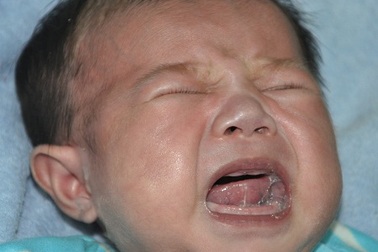 Ánh mắt khát sống của bé 2 tháng tuổi bị tim bẩm sinh