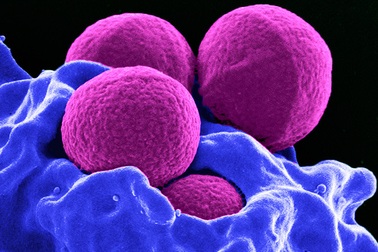 Phương pháp mới điều trị nhiễm trùng kháng kháng sinh