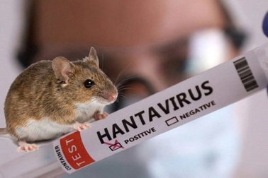 Những điều cần biết về loại virus Hanta nguy hiểm chết người