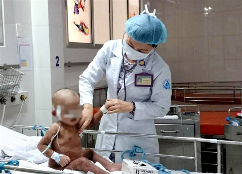 TPHCM: Cha mẹ xông hơi trị Covid-19 cho con, nhiều trẻ bỏng nặng thương tâm - 2 TPHCM: Cha mẹ xông hơi trị Covid-19 cho con, nhiều trẻ bỏng nặng thương tâm - 2