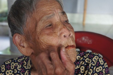 Xôn xao câu chuyện cụ bà 98 tuổi mọc răng