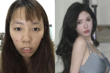 Hot girl Trung Quốc phẫn nộ khi bị tung ảnh thời còn xấu xí, chưa dao kéo