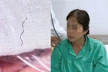 Hai người phụ nữ suýt mất Tết vì gặp tai nạn nguy hiểm trong bữa ăn