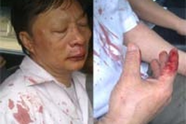 Hẹn chủ nợ đến nhà, chốt cửa hành hung