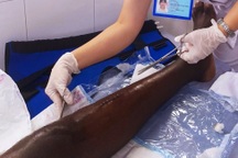 TPHCM: Người đàn ông bị tai nạn nghiêm trọng trong lúc chơi bóng đá