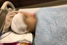 Công an Hải Dương lên tiếng vụ Phó Chủ tịch xã bị đánh vỡ hộp sọ