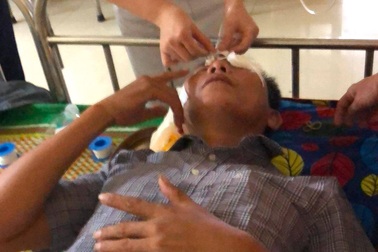 Đến trụ sở xã làm việc vì đơn tố cáo, người đàn ông bị kẻ lạ tấn công