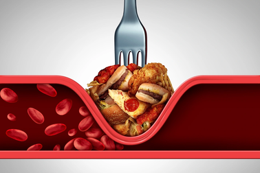 Lý do tình trạng gần 50% người trưởng thành thành thị bị mỡ máu cao