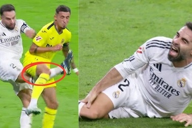 Ngôi sao Real Madrid chấn thương nghiêm trọng, cẳng chân biến dạng