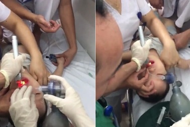 Nửa tiếng giành lại sự sống cho bé trai 2 tuổi ngưng thở vì hóc thạch rau câu