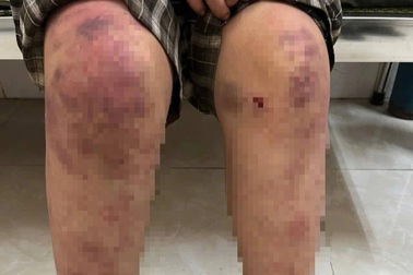 Vụ bé gái ở Thái Nguyên bị bà nội tra khảo, hành hạ: 4 tiếng "địa ngục"