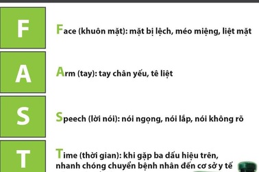 Mùa nắng nóng: nguy cơ đột quỵ tăng cao