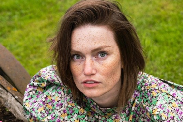 Gương mặt đầy tàn nhang của HHHV Na Uy và sự phá bỏ những chuẩn mực sắc đẹp