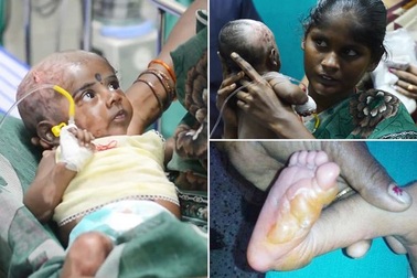 Cố tình làm con bỏng rồi đổ cho "người tự cháy"