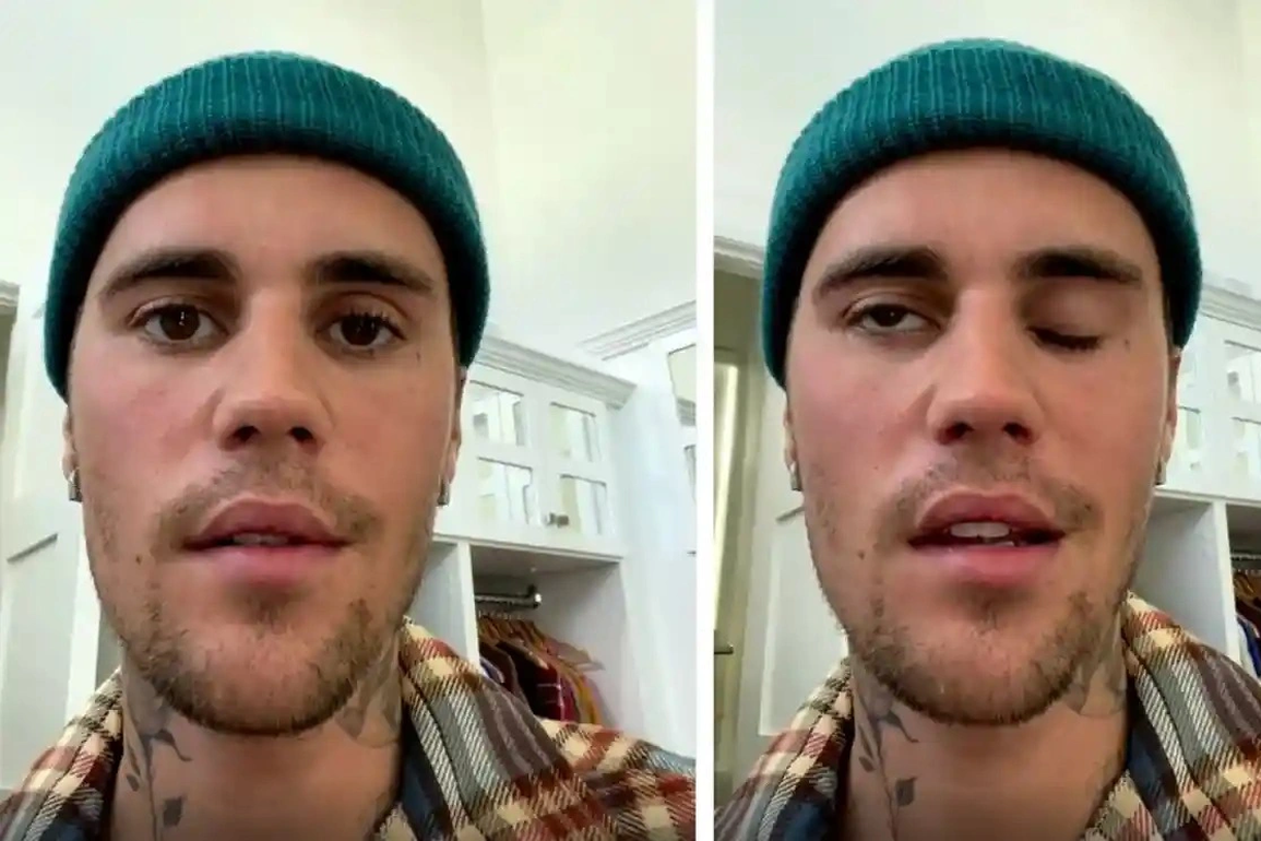 Justin Bieber hủy show vì bị liệt nửa mặt: Vận đen tới tấp ập đến! - 1 Justin Bieber hủy show vì bị liệt nửa mặt: Vận đen tới tấp ập đến! - 1