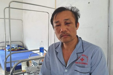 Giám đốc công ty bất động sản bị tố đánh chủ đất nhập viện