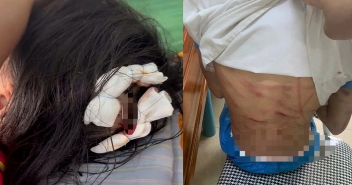 Khi trẻ em thành "vật trung gian chịu trận" và sự lệch lạc trong tâm lý