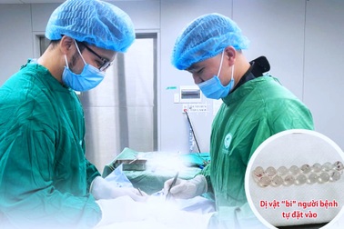 Tự đặt bi “tăng khoái cảm", người đàn ông 54 tuổi nhập viện cấp cứu