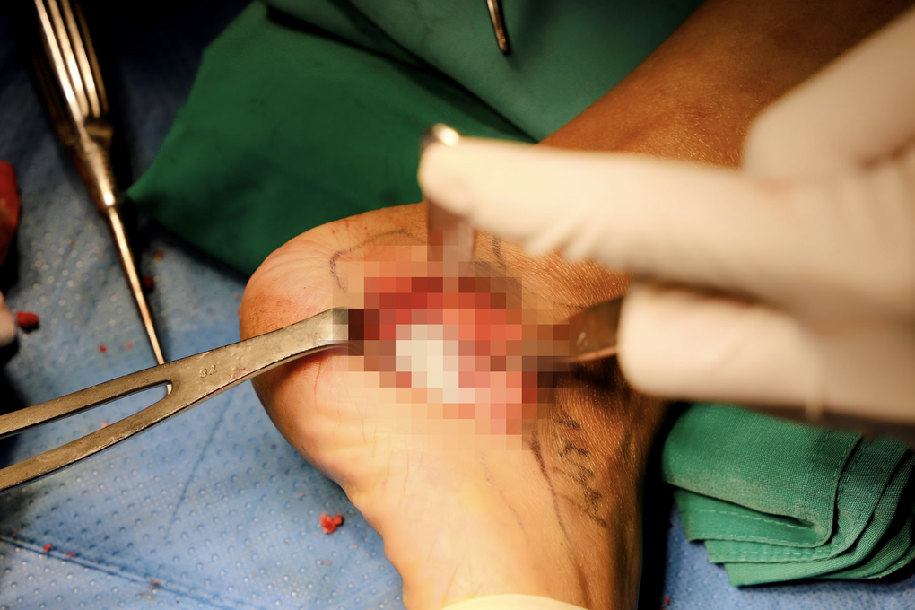 Mắc bệnh lạ, mẹ gãy xương khắp người chịu đau đớn tột cùng để sinh con - 4 Mắc bệnh lạ, mẹ gãy xương khắp người chịu đau đớn tột cùng để sinh con - 4