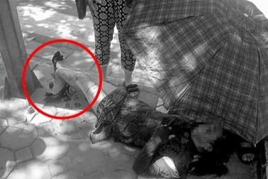 Người phụ nữ bị gãy gập chân vì áo chống nắng cuốn vào bánh xe máy