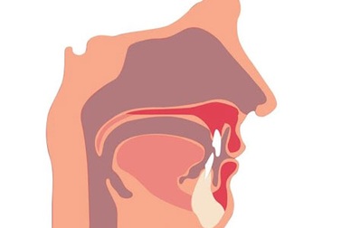 Vì sao thuốc Nam chữa xoang hiệu quả?