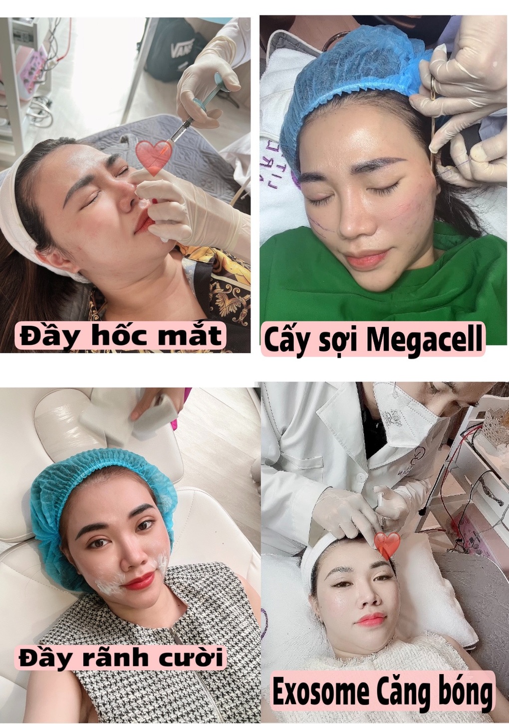 Tìm lại thanh xuân ngay và luôn bằng công nghệ xóa nhăn siêu đa bào - 4 Tìm lại thanh xuân ngay và luôn bằng công nghệ xóa nhăn siêu đa bào - 4