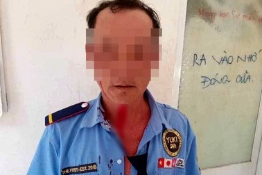 Nhắc nam thanh niên đeo khẩu trang, người bảo vệ bị đánh bầm mặt