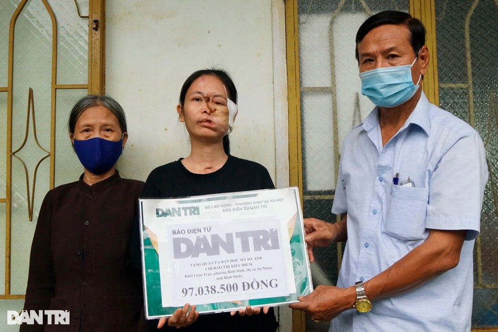 Bạn đọc ủng hộ hơn 324 triệu đồng giúp cô gái có khuôn mặt biến dạng - 1 Bạn đọc ủng hộ hơn 324 triệu đồng giúp cô gái có khuôn mặt biến dạng - 1