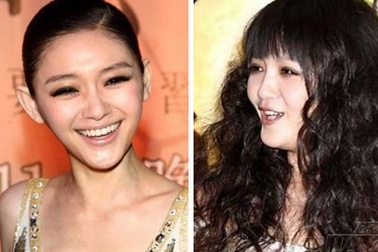 Những mỹ nhân mặt bỗng sưng vù vì phẫu thuật thẩm mỹ