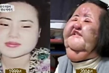 Cuộc sống lạnh lẽo của “thảm họa phẫu thuật” xứ Hàn 