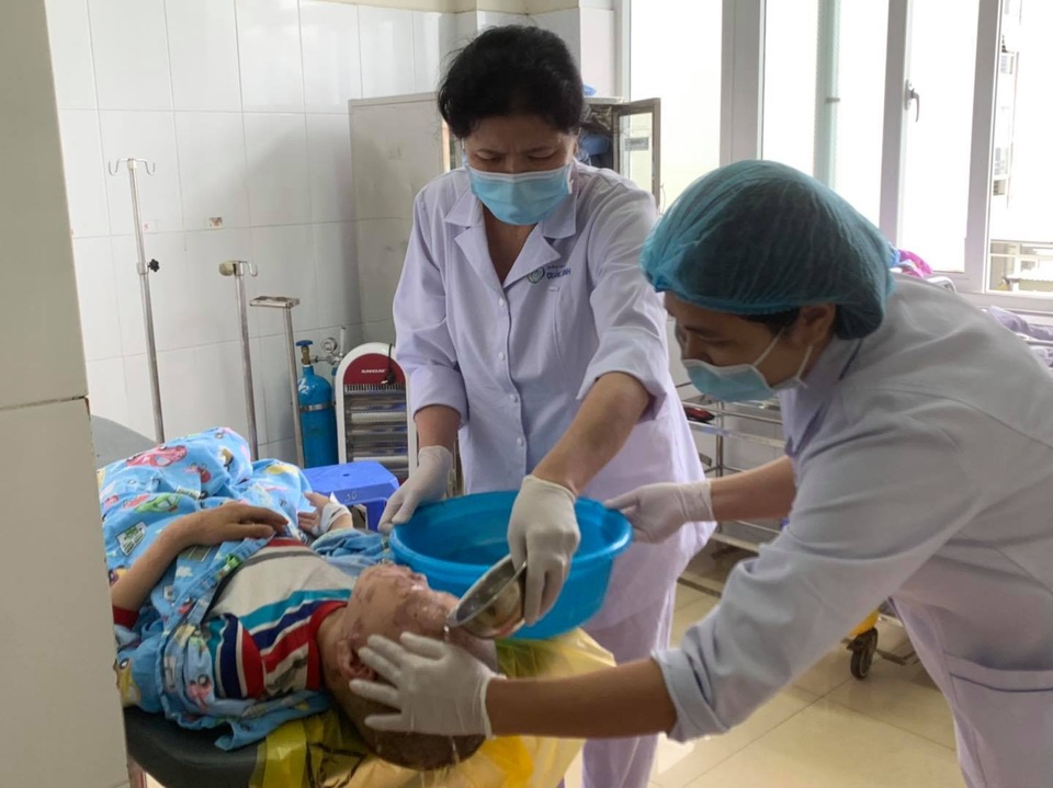 Bé 10 tuổi bỏng nặng vùng mặt vì nghịch dại theo video trên mạng - 2 Bé 10 tuổi bỏng nặng vùng mặt vì nghịch dại theo video trên mạng - 2