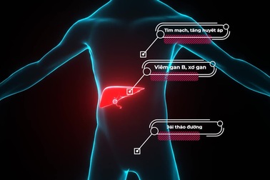 Hành trình điều trị thành công u gan của bệnh nhân