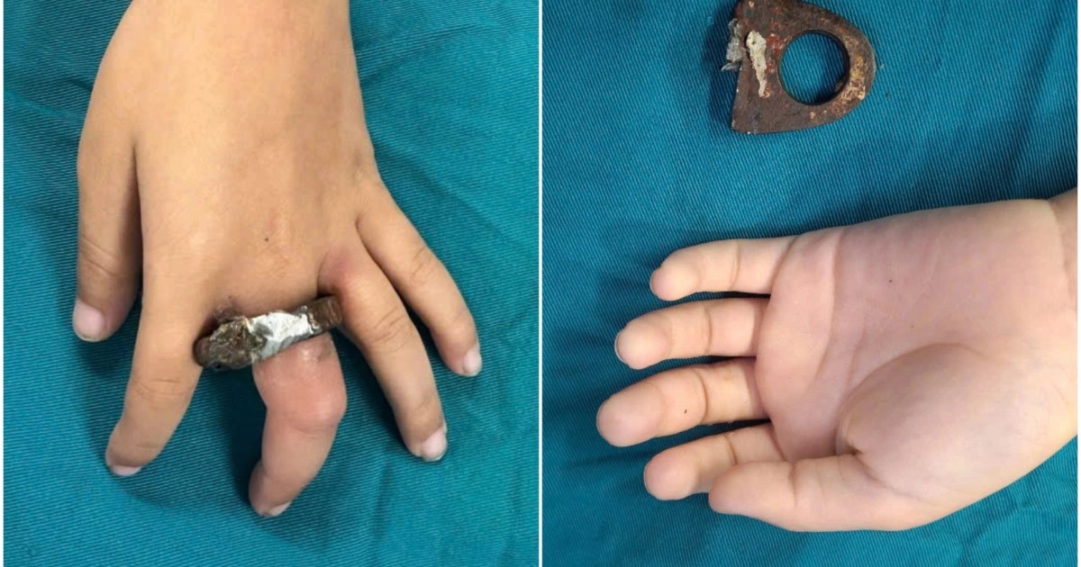 Hà Nội: Gia đình cưa cổng giải cứu bé trai kẹt tay trong vòng khóa