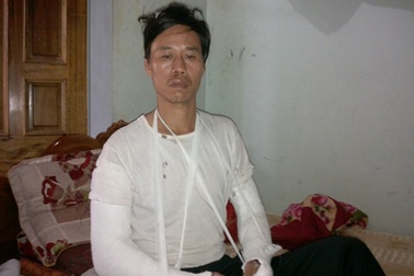 Vào can ngăn, một thầy giáo bị đánh trọng thương