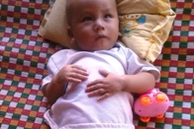 Bé 11 tháng tuổi tím tái vì bệnh tim bẩm sinh