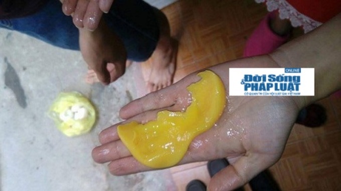 Trứng vịt có lòng trắng bám “như đỉa” gây hoang mang