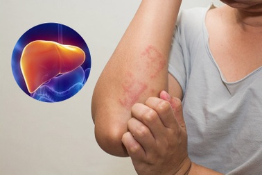 7 điều cần nhớ để lá gan nói không với bệnh tật