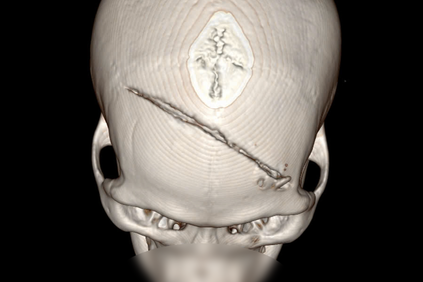 Thanh niên dập não nặng, vượt hàng trăm km đến TPHCM và cái kết vỡ oà